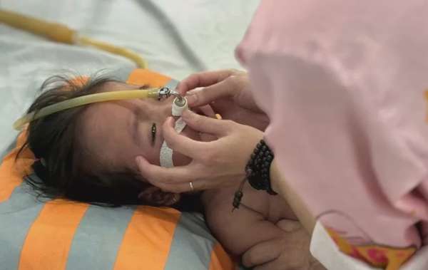 Trẻ nhiễm sởi có thể bị các biến chứng nặng. Ảnh: Hoàng Lê