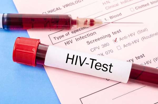 Cơ quan nào có thẩm quyền để lấy mẫu xét nghiệm HIV?