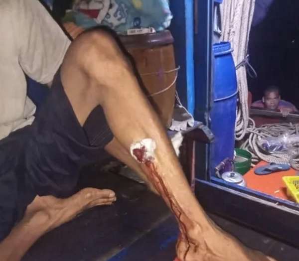Kiên Giang: Ngư dân trình báo bị tấn công bằng bom xăng và đạn chì