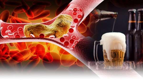 Uống nhiều rượu bia tăng nguy cơ đột quỵ trong mùa lạnh