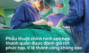Ảnh bài viết
